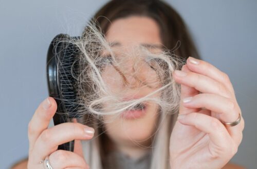 wypadanie włosów