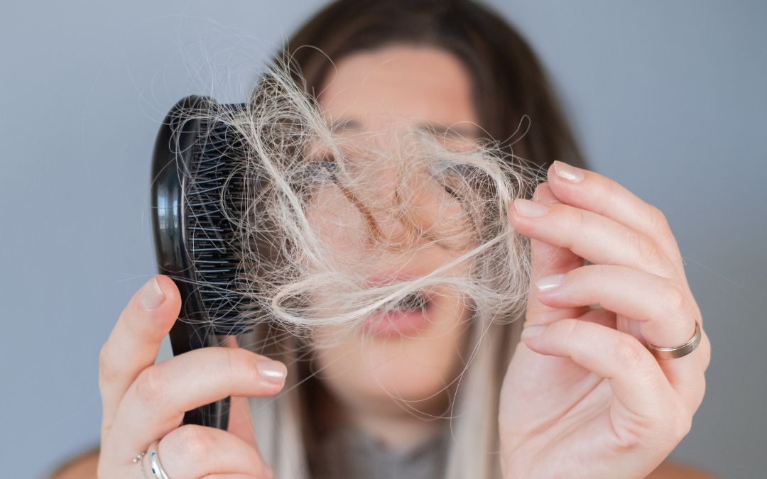 wypadanie włosów